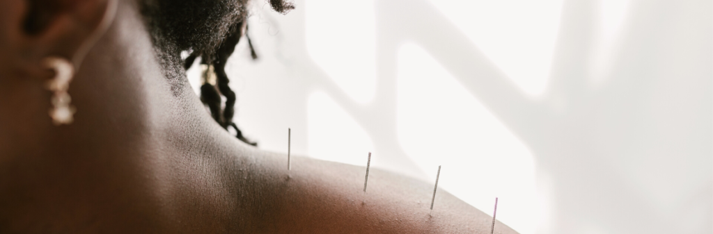 Acupunctuur bij Dana